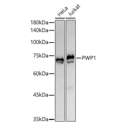Western Blot - Anti-PWP1 Antibody [ARC3017] (A309452) - Antibodies.com