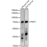 Western Blot - Anti-PWP1 Antibody [ARC3017] (A309452) - Antibodies.com