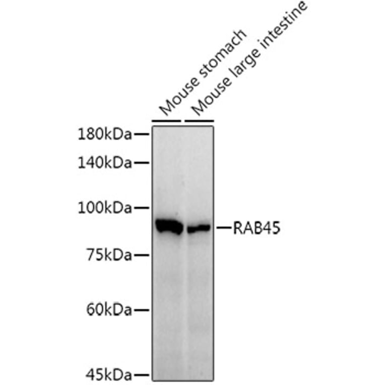 Western Blot - Anti-RAB45 Antibody [ARC3022] (A309455) - Antibodies.com