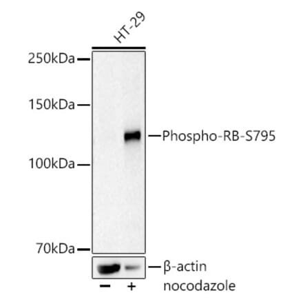 Western Blot - Anti-Rb (phospho Ser795) Antibody [ARC52788] (A309456) - Antibodies.com
