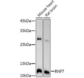 Western Blot - Anti-RNF7 Antibody [ARC3065] (A309459) - Antibodies.com
