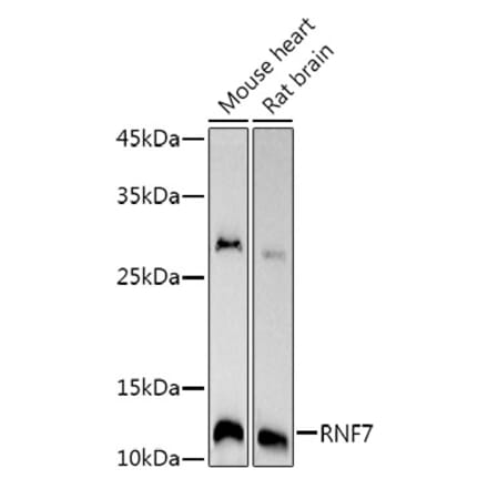 Western Blot - Anti-RNF7 Antibody [ARC3065] (A309459) - Antibodies.com