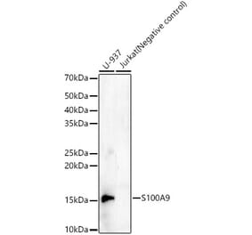 Western Blot - Anti-S100A9 Antibody [ARC55864 + ARC55869] (A309461) - Antibodies.com