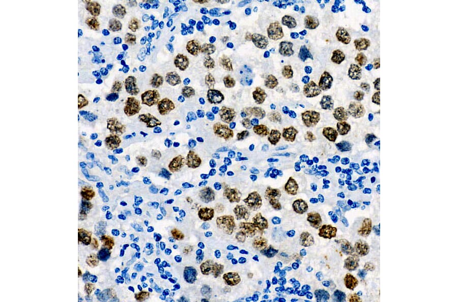 Immunohistochemistry - Anti-Sall4 Antibody [ARC57452] (A309463) - Antibodies.com