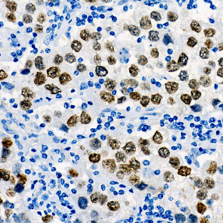 Immunohistochemistry - Anti-Sall4 Antibody [ARC57452] (A309463) - Antibodies.com