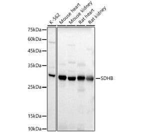 Western Blot - Anti-SDHB Antibody (A309465) - Antibodies.com