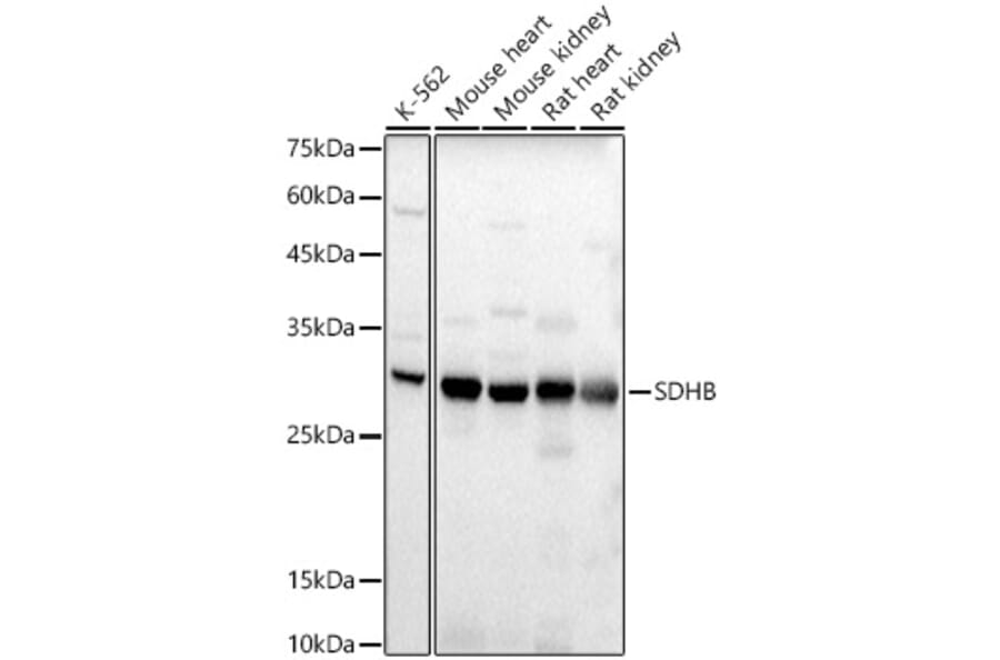 Western Blot - Anti-SDHB Antibody (A309465) - Antibodies.com