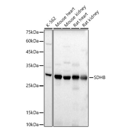 Western Blot - Anti-SDHB Antibody (A309465) - Antibodies.com