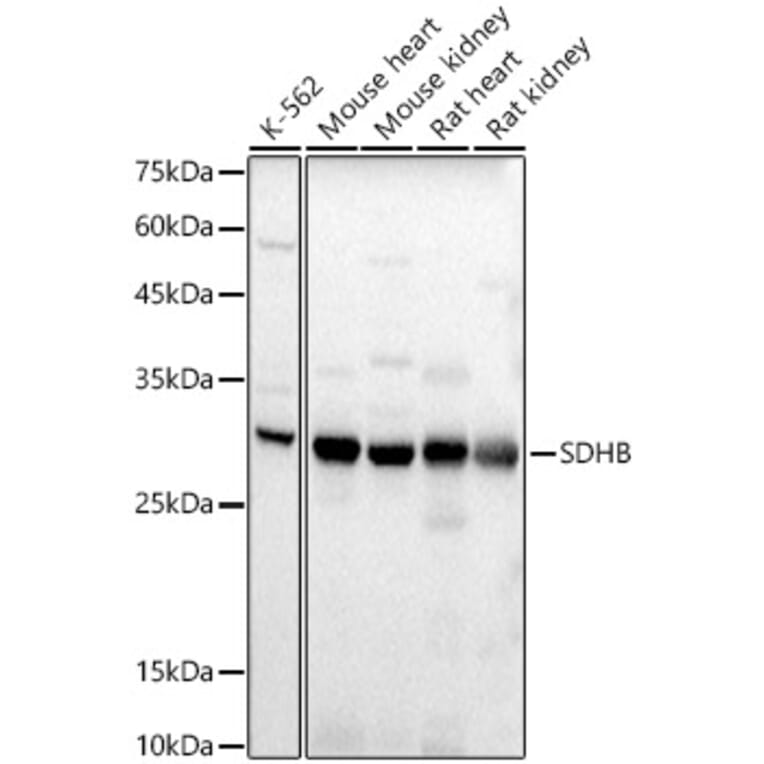 Western Blot - Anti-SDHB Antibody (A309465) - Antibodies.com