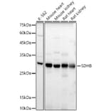 Western Blot - Anti-SDHB Antibody (A309465) - Antibodies.com
