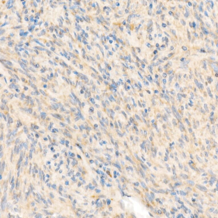 Immunohistochemistry - Anti-SDHB Antibody (A309465) - Antibodies.com