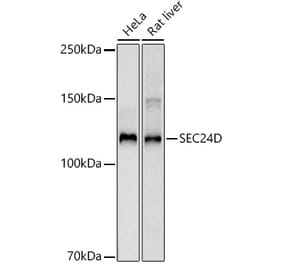 Western Blot - Anti-SEC24D Antibody [ARC3016] (A309466) - Antibodies.com