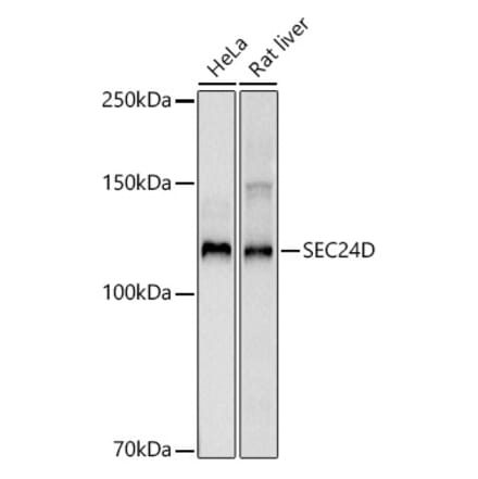 Western Blot - Anti-SEC24D Antibody [ARC3016] (A309466) - Antibodies.com