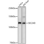 Western Blot - Anti-SEC24D Antibody [ARC3016] (A309466) - Antibodies.com