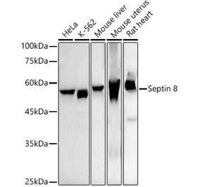 Western Blot - Anti-Septin 8 Antibody [ARC2988] (A309467) - Antibodies.com