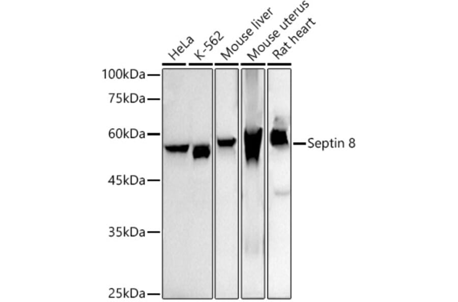 Western Blot - Anti-Septin 8 Antibody [ARC2988] (A309467) - Antibodies.com