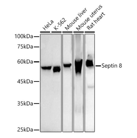 Western Blot - Anti-Septin 8 Antibody [ARC2988] (A309467) - Antibodies.com