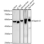 Western Blot - Anti-Septin 8 Antibody [ARC2988] (A309467) - Antibodies.com