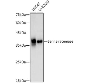 Western Blot - Anti-Serine racemase Antibody [ARC3047] (A309468) - Antibodies.com