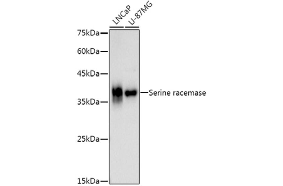 Western Blot - Anti-Serine racemase Antibody [ARC3047] (A309468) - Antibodies.com