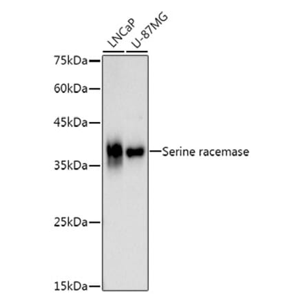 Western Blot - Anti-Serine racemase Antibody [ARC3047] (A309468) - Antibodies.com