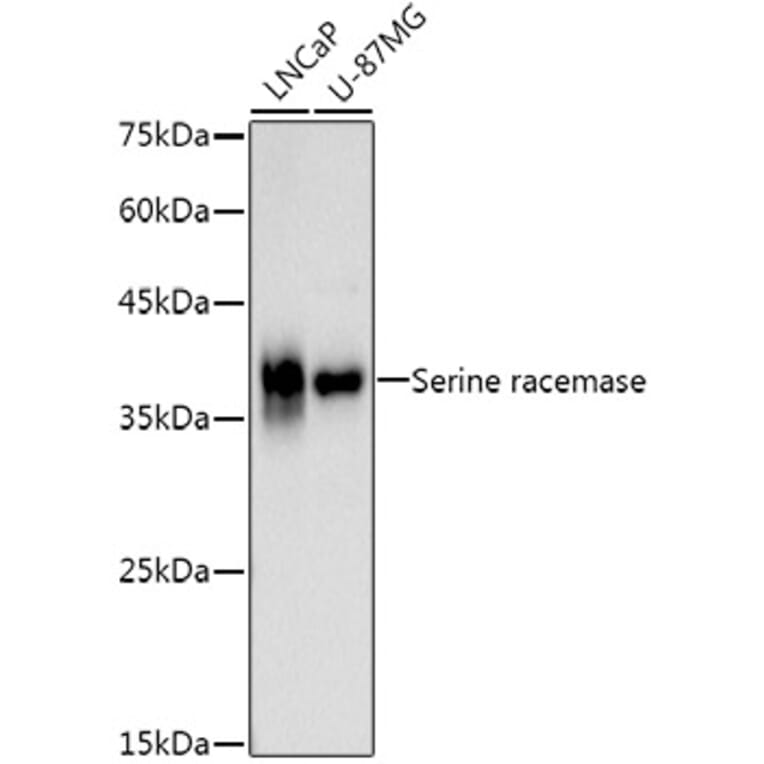 Western Blot - Anti-Serine racemase Antibody [ARC3047] (A309468) - Antibodies.com