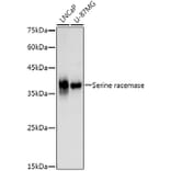 Western Blot - Anti-Serine racemase Antibody [ARC3047] (A309468) - Antibodies.com