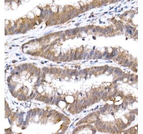 Immunohistochemistry - Anti-SFT Antibody [ARC2935] (A309469) - Antibodies.com