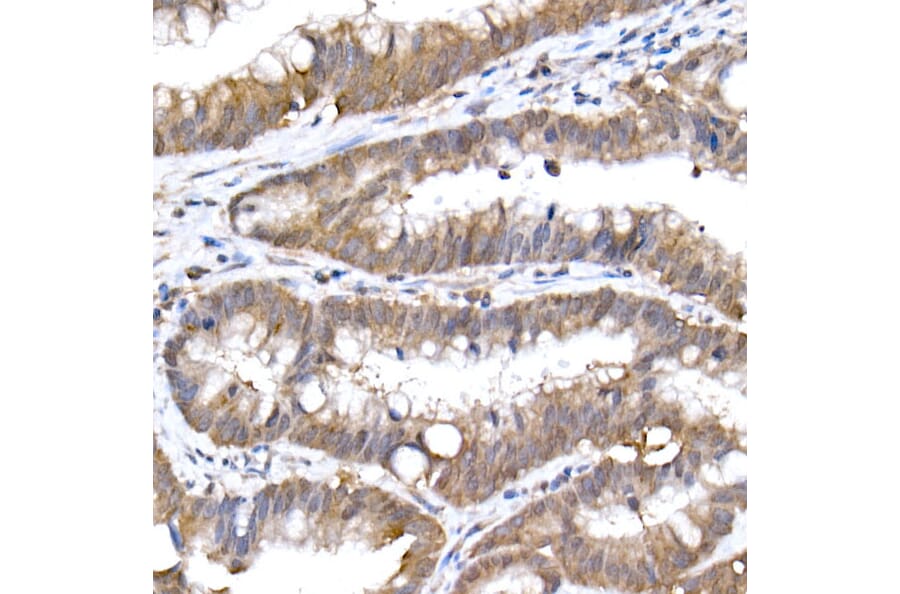 Immunohistochemistry - Anti-SFT Antibody [ARC2935] (A309469) - Antibodies.com