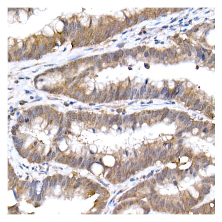 Immunohistochemistry - Anti-SFT Antibody [ARC2935] (A309469) - Antibodies.com