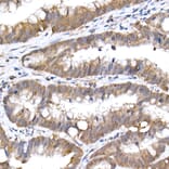 Immunohistochemistry - Anti-SFT Antibody [ARC2935] (A309469) - Antibodies.com