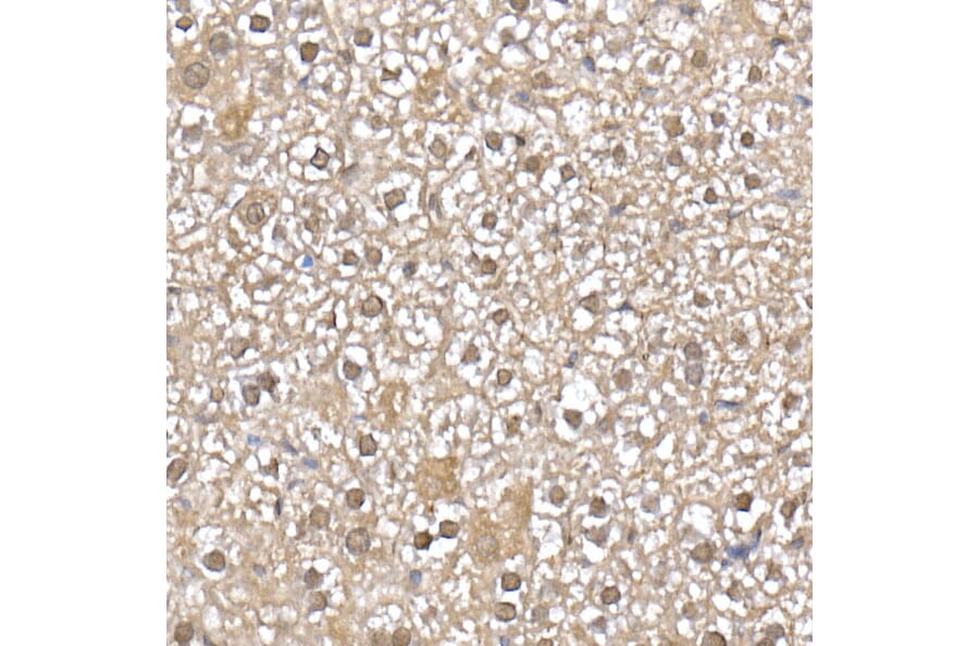 Immunohistochemistry - Anti-SFT Antibody [ARC2935] (A309469) - Antibodies.com