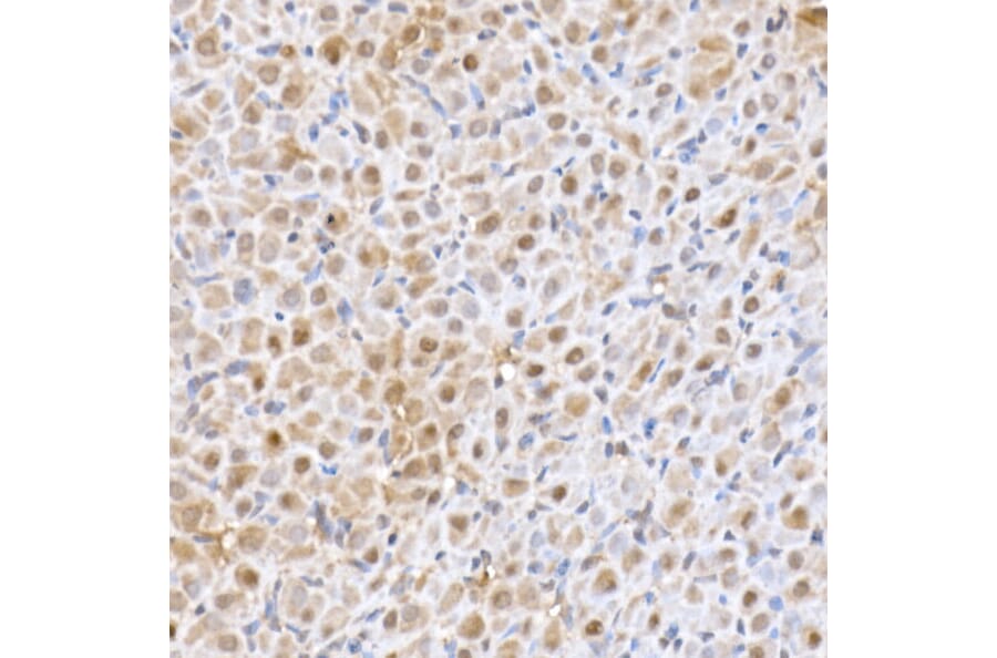 Immunohistochemistry - Anti-SFT Antibody [ARC2935] (A309469) - Antibodies.com