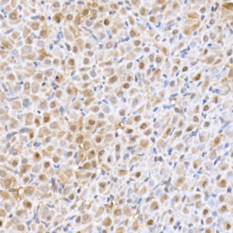 Immunohistochemistry - Anti-SFT Antibody [ARC2935] (A309469) - Antibodies.com