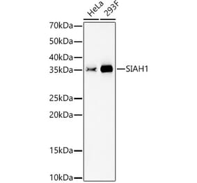 Western Blot - Anti-SIAH1 Antibody [ARC59737] (A309470) - Antibodies.com
