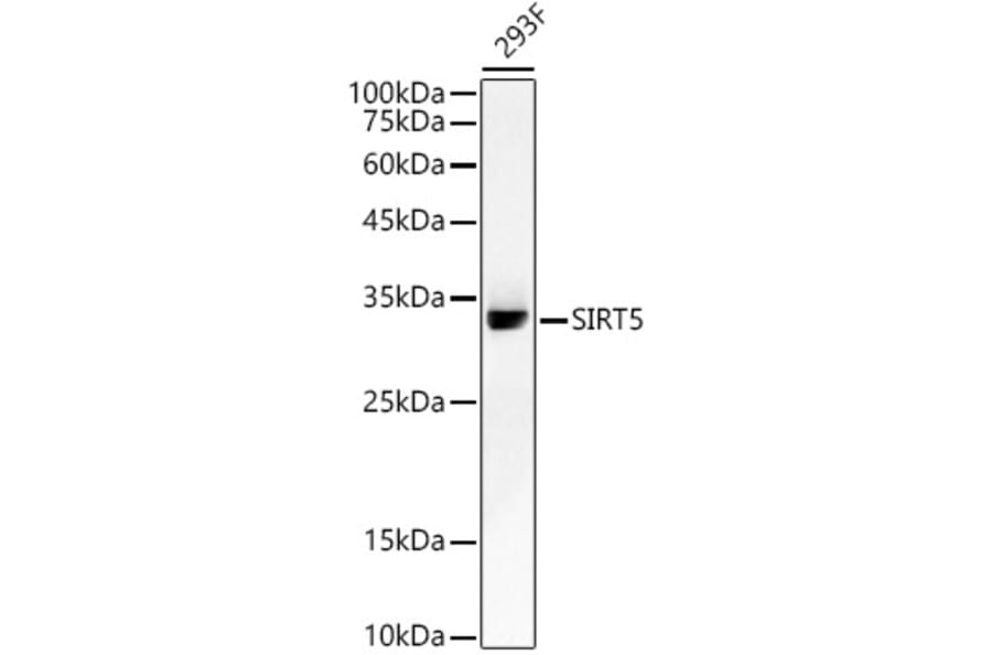 Western Blot - Anti-SIRT5 Antibody [ARC59763] (A309471) - Antibodies.com