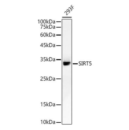 Western Blot - Anti-SIRT5 Antibody [ARC59763] (A309471) - Antibodies.com