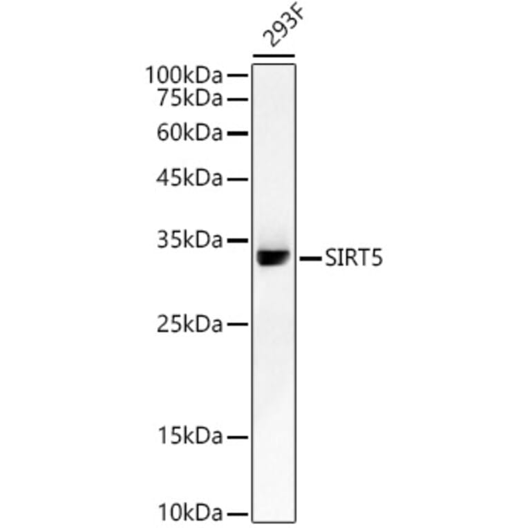 Western Blot - Anti-SIRT5 Antibody [ARC59763] (A309471) - Antibodies.com