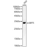 Western Blot - Anti-SIRT5 Antibody [ARC59763] (A309471) - Antibodies.com