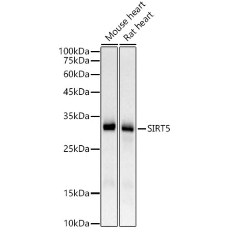 Western Blot - Anti-SIRT5 Antibody [ARC59763] (A309471) - Antibodies.com