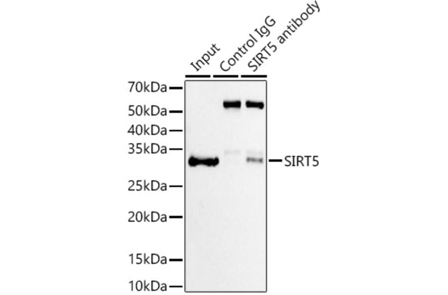 Western Blot - Anti-SIRT5 Antibody [ARC59763] (A309471) - Antibodies.com