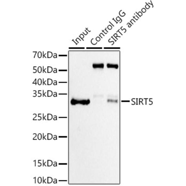 Western Blot - Anti-SIRT5 Antibody [ARC59763] (A309471) - Antibodies.com
