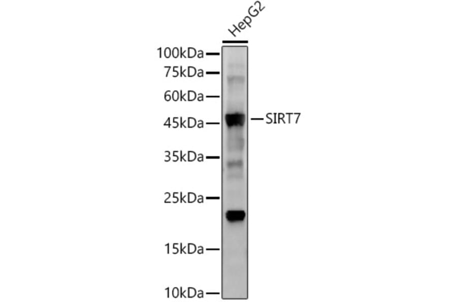 Western Blot - Anti-SIRT7 Antibody [ARC56567] (A309472) - Antibodies.com