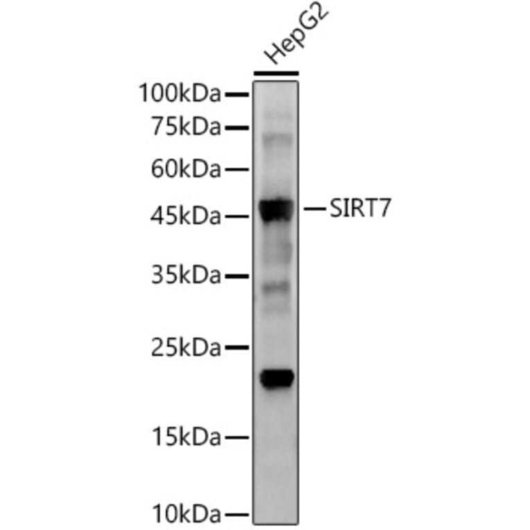 Western Blot - Anti-SIRT7 Antibody [ARC56567] (A309472) - Antibodies.com