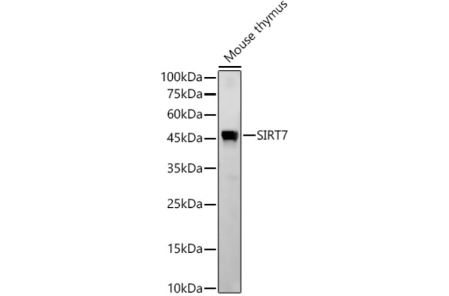 Western Blot - Anti-SIRT7 Antibody [ARC56567] (A309472) - Antibodies.com