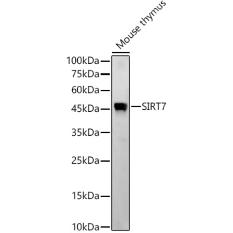 Western Blot - Anti-SIRT7 Antibody [ARC56567] (A309472) - Antibodies.com