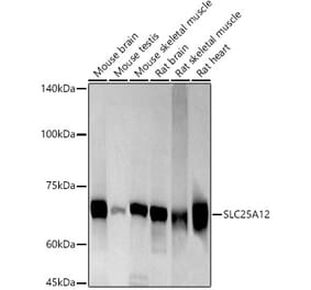 Western Blot - Anti-SLC25A12 Antibody [ARC3041] (A309473) - Antibodies.com