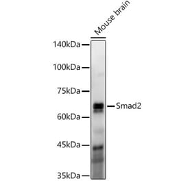 Western Blot - Anti-Smad2 Antibody [ARC57635] (A309474) - Antibodies.com