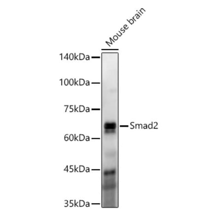 Western Blot - Anti-Smad2 Antibody [ARC57635] (A309474) - Antibodies.com
