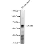 Western Blot - Anti-Smad2 Antibody [ARC57635] (A309474) - Antibodies.com